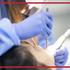 فرق درمان ریشه دندان با عصب کشی چیست؟